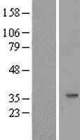 SLC25A20 (NM_000387) Human Tagged ORF Clone