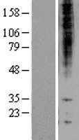 Proteasome beta 1(PSMB1) (NM_002793) Human Tagged ORF Clone