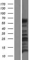Calcitonin receptor(CALCR) (NM_001164737) Human Tagged ORF Clone