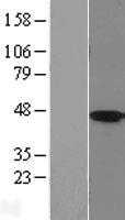 HSD11B2 (NM_000196) Human Tagged ORF Clone