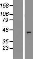 CCXCR1(XCR1) (NM_005283) Human Tagged ORF Clone