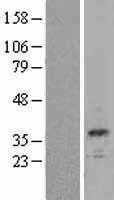 Calbindin(CALB1) (NM_004929) Human Tagged ORF Clone