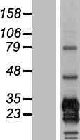 CD79B (NM_000626) Human Tagged ORF Clone