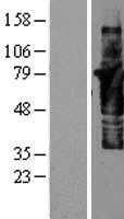 Cortactin(CTTN) (NM_138565) Human Tagged ORF Clone