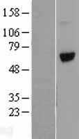 Vitronectin(VTN) (NM_000638) Human Tagged ORF Clone