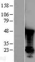 PARK7 (NM_007262) Human Tagged ORF Clone