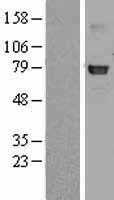 GLB1 (NM_000404) Human Tagged ORF Clone
