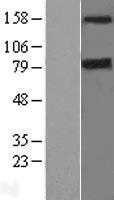 DAP Kinase 1(DAPK1) (NM_004938) Human Tagged ORF Clone