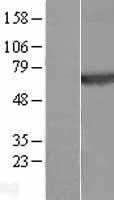 Plexin A4(PLXNA4) (NM_181775) Human Tagged ORF Clone