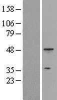 Cytokeratin 18(KRT18) (NM_000224) Human Tagged ORF Clone