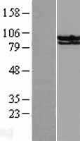STAT6 (NM_003153) Human Tagged ORF Clone