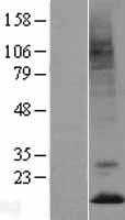 Prokineticin 2(PROK2) (NM_021935) Human Tagged ORF Clone
