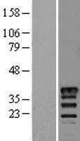 MSI2 (NM_138962) Human Tagged ORF Clone