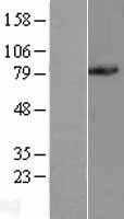 PC1/3(PCSK1) (NM_000439) Human Tagged ORF Clone