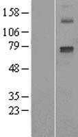 Cytochrome P450 2E1(CYP2E1) (NM_000773) Human Tagged ORF Clone