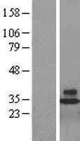 CD48 (NM_001778) Human Tagged ORF Clone