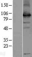 USP13 (NM_003940) Human Tagged ORF Clone