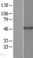 HNRPH2(HNRNPH2) (NM_019597) Human Tagged ORF Clone