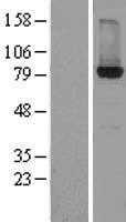 Hydroxysteroid (17 beta) Dehydrogenase 4(HSD17B4) (NM_000414) Human Tagged ORF Clone