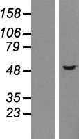 Choline kinase alpha(CHKA) (NM_212469) Human Tagged ORF Clone