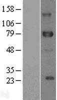 DLL1 (NM_005618) Human Tagged ORF Clone