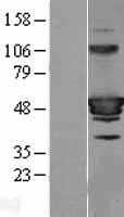 HIC5(TGFB1I1) (NM_001164719) Human Tagged ORF Clone