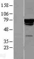 p60 CAF1(CHAF1B) (NM_005441) Human Tagged ORF Clone