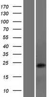 DNAJC5B (NM_033105) Human Tagged ORF Clone