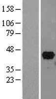 PITX2 (NM_153426) Human Tagged ORF Clone