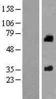 SOAT 2(SOAT2) (NM_003578) Human Tagged ORF Clone