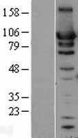 HSP90AB1 (NM_007355) Human Tagged ORF Clone