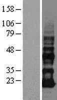 VOPP1 (NM_030796) Human Tagged ORF Clone