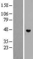 RHBDL1 (NM_003961) Human Tagged ORF Clone