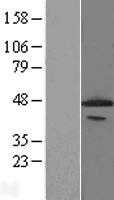 PCYT1A (NM_005017) Human Tagged ORF Clone