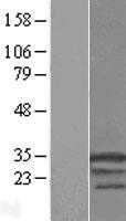 Hsp22(HSPB8) (NM_014365) Human Tagged ORF Clone