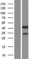 MBNL2 (NM_144778) Human Tagged ORF Clone