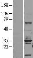 STEAP1 (NM_012449) Human Tagged ORF Clone