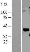 CCN1(CYR61) (NM_001554) Human Tagged ORF Clone