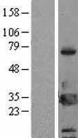 14 3 3 eta(YWHAH) (NM_003405) Human Tagged ORF Clone