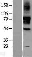 SIGLEC9 (NM_014441) Human Tagged ORF Clone