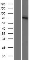 SLC6A12 (NM_001122847) Human Tagged ORF Clone