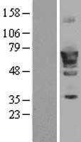 PDE1B (NM_000924) Human Tagged ORF Clone