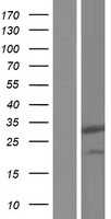 PIH1D3 (NM_001169154) Human Tagged ORF Clone