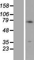 Melanoma gp100(PMEL) (NM_006928) Human Tagged ORF Clone