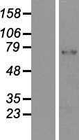PADI2(PADI2) (NM_007365) Human Tagged ORF Clone