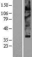VMAT2(SLC18A2) (NM_003054) Human Tagged ORF Clone