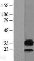 CD20(MS4A1) (NM_152866) Human Tagged ORF Clone