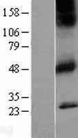 CHRM1 (NM_000738) Human Tagged ORF Clone