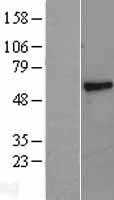 PSAP (NM_002778) Human Tagged ORF Clone