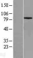 Mitofusin 1(MFN1) (NM_033540) Human Tagged ORF Clone